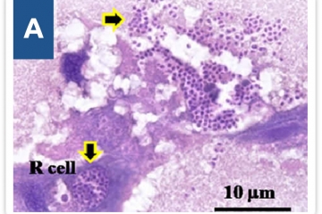 EHP TRÊN TÔM - NGUYÊN NHÂN VÀ CÁCH PHÒNG NGỪA